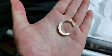 Bursa’da Akılalmaz Olay: 1 TL’den Yaptığı Yüzük Yüzünden Parmağını Kaybediyordu