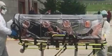 Corona Virisünün Mikroskobik Görüntüleri Paylaşıldı