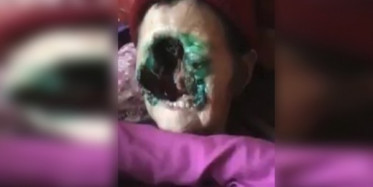 Dehşete Düşüren Görüntü Sosyal Medyayı Karıştırdı