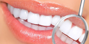 Dişlerinizi Bembeyaz Yapacak Yöntemler