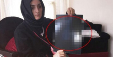 Genç Kadının Karnından Öyle Bir Şey Çıktı ki!