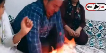 TikTok Uğruna Kocasının Ellerini Yaktı