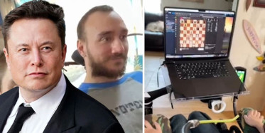 Elon Musk görüntüleri paylaştı: Felçli gencin beynine çip yerleştirildi sonrası tam bir mucize!