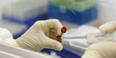 Domuz Gribi Nasıl Tedavi Edilir?