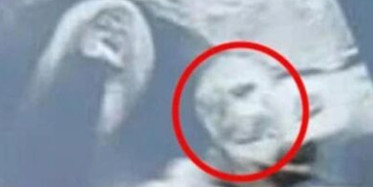 Hamile Kadın Ultrason Fotoğrafında Büyükbabasını Gördü