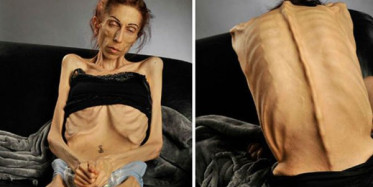 Git Gide Eriyen Kadın Bakın Şimdi Ne Halde?