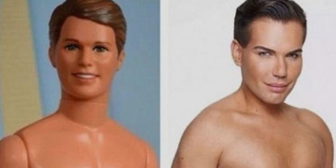 Oyuncak Bebeğe Benzeyecek Diye 190 Kere Ameliyat Oldu