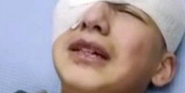 İsrail Güçleri, Filistinli Çocuğu Plastik Mermiyle Gözünden Vurdu