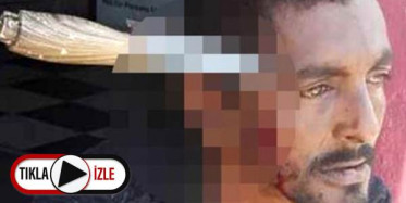 Kafasına Bıçak Saplandı, 3 Gün Sonra Hayatına Devam Etti
