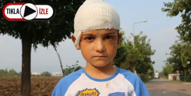 Kangal 8 Yaşındaki Çocuğa Saldırdı: 52 Dikişi Atıldı