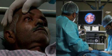 Kara Mantar Hastalığında İlginç Tedavi Yönetimi Tek Göz Ameliyatla Çıkarılıyor