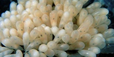 Genç Kızın Karnından Öyle Bir Şey Çıktı ki!