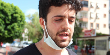 Köpeklerini Gezdiren Genç Sokak Ortasında Saldırıya Uğradı