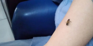 Kovid-19'a İyi Geldiğini Öne Sürerek Kendilerini Arılara Isırtıyorlar