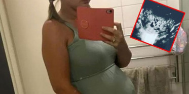 Molar Gebelik Geçiren Lauren Knowles Tümör Doğurdu