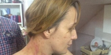 Tıkanan Lavaboya Açıcı Dökünce Başına Gelmeyen Kalmadı