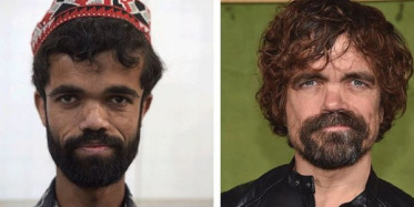Pakistanlı Rozi Khan, Game of Thrones'taki Tyrion Lannister Karakterine Benzerliği ile Dikkat Çekiyor
