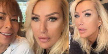 Seda Sayan gençleşmek uğruna öyle bir şey yaptı ki! Sünnet derisini...