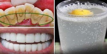 Tartarı Ortadan Kaldırmanın En Güzel Yolları!