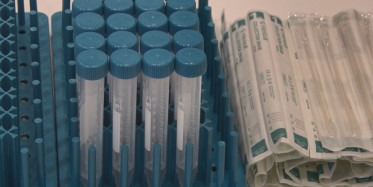 Türk Bilim İnsanları, Koronavirüsü 10 Saniyede Tanıyan Kit Geliştirdi