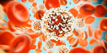 Türk Doktordan Kan Kanseri İçin Umut Veren Çalışma