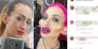 Ukraynalı modelden estetik terörü: Duru güzelliğini öyle bir hale getirdi ki! Artık korku filmlerinde oynayabilir...